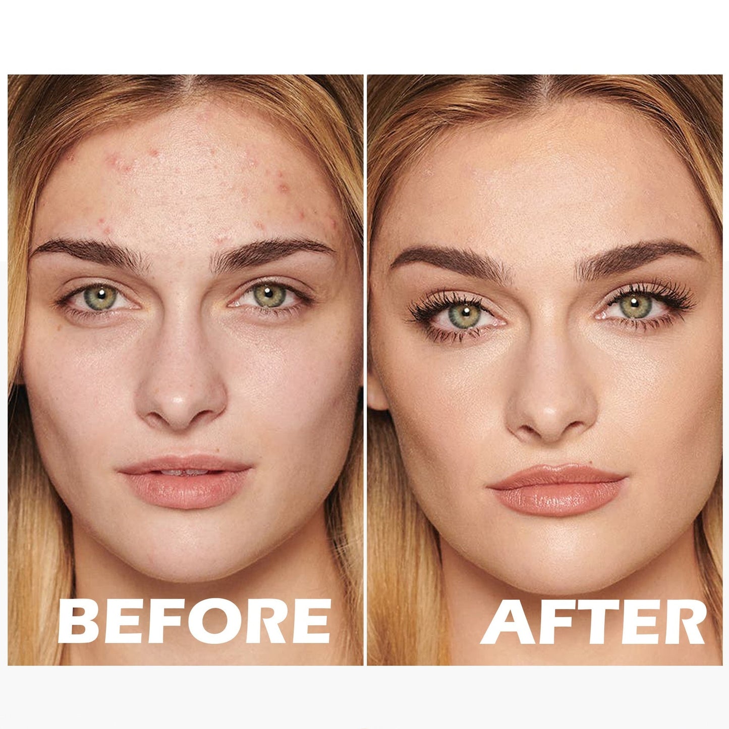 Lovilds™ Skin Perfecting BB Cream